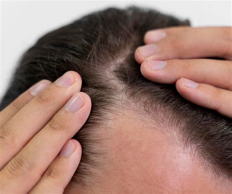 pelo ensortijado causas|Pelo de alambre en hombres: causas, cuidados y tratamientos